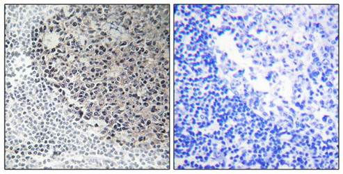 Collagen IX α3 Antibody