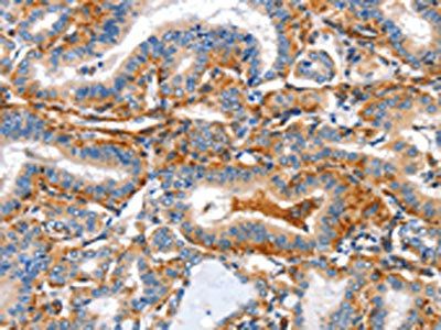 AIFM3 Antibody