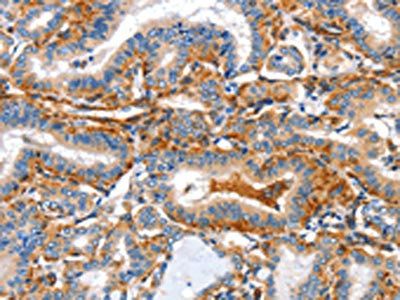 AIFM3 antibody