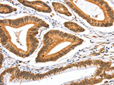 AIFM3 Antibody