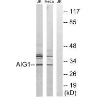 AIG1 antibody
