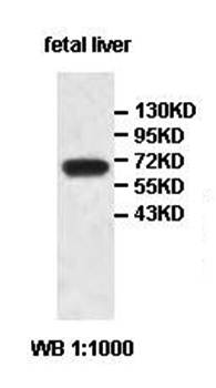 AIM1L Rabbit Polyclonal Antibody