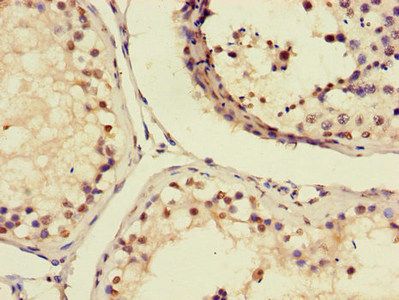 AIM2 Antibody
