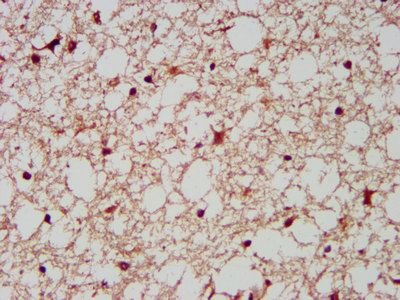 AIMP1 Antibody