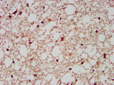 AIMP1 antibody