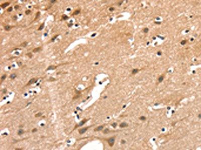 AIMP1 Antibody
