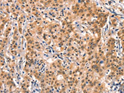 AIMP1 antibody