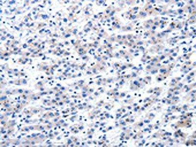 AIMP2 Antibody