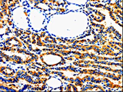 AIMP2 antibody