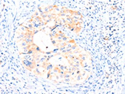AIMP2 Antibody