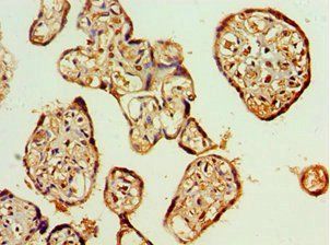 AIPL1 Antibody
