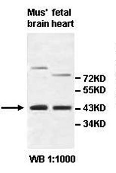 AIPL1 Rabbit Polyclonal Antibody