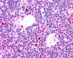 Goat anti-AIRE Antibody