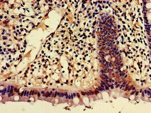 AJAP1 Antibody