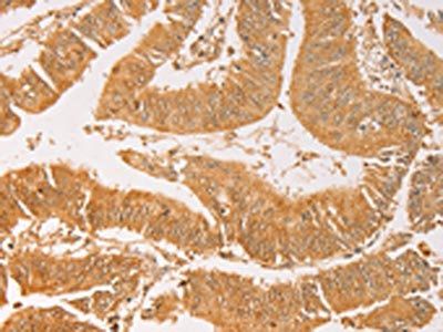 AK2 Antibody