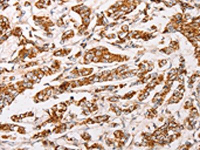 AK2 Antibody
