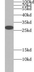 AK2 antibody