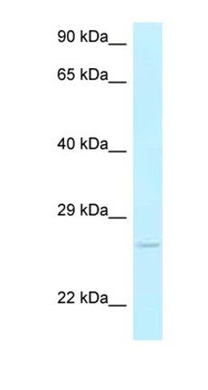 Ak3 antibody