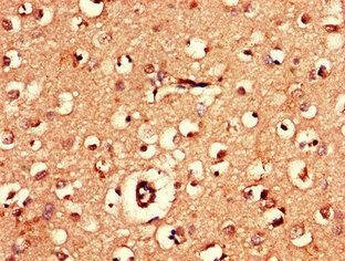 AK5 Antibody