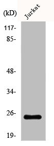 AK5 antibody