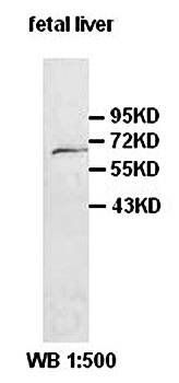 AK5 Rabbit Polyclonal Antibody