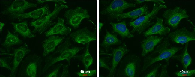 AK8 antibody [N3C3]
