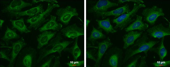 AK8 antibody