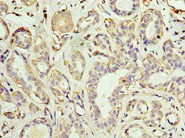 AKAP10 Antibody