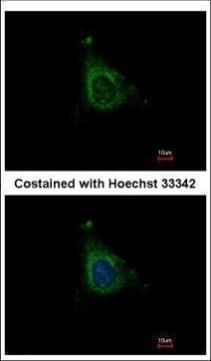 AKAP10 antibody [C3], C-term