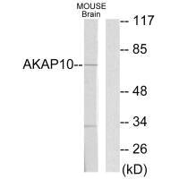 AKAP10 antibody
