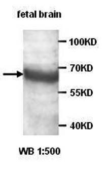 AKAP10 Rabbit Polyclonal Antibody