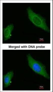 AKAP12 Rabbit Polyclonal Antibody