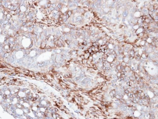 AKAP12 Rabbit Polyclonal Antibody