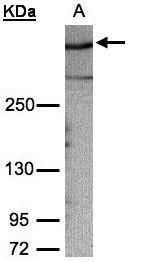 AKAP12 Rabbit Polyclonal Antibody