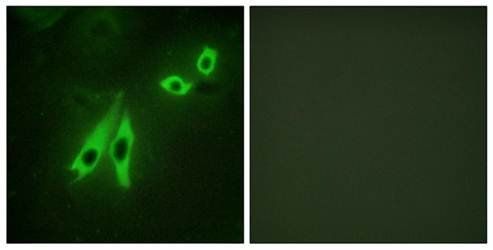 AKAP3 Antibody