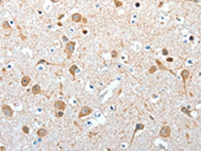 AKAP4 Antibody
