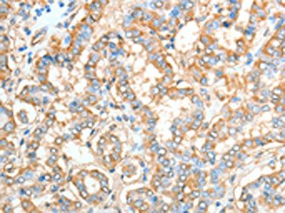 AKAP4 Antibody