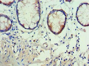 AKAP5 Antibody