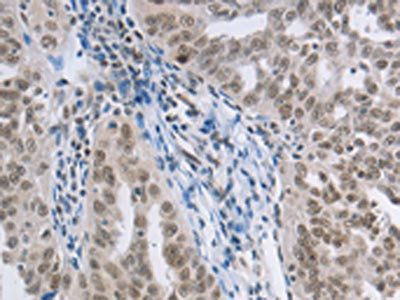 AKAP8 Antibody
