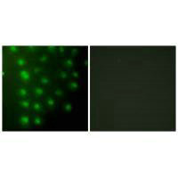AKAP8 Antibody