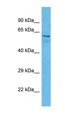 AKAP8L antibody