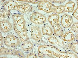 AKAP8L Antibody