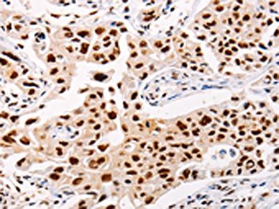 AKAP8L Antibody