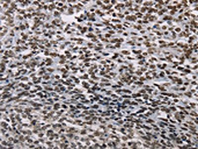 AKAP8L Antibody