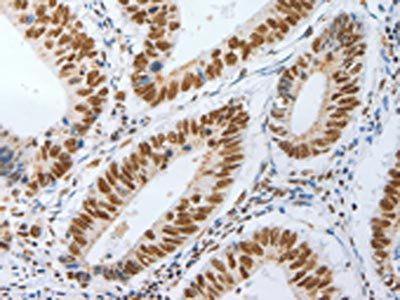 AKAP8L Antibody