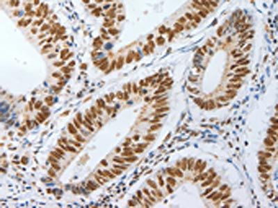 AKAP8L antibody