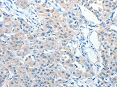 AKAP9 Antibody