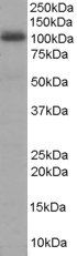 Goat anti-AKAP8 / AKAP95 Antibody