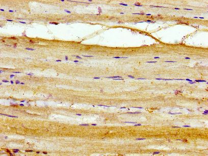 AKIP1 Antibody