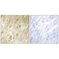 AKIP1 Antibody